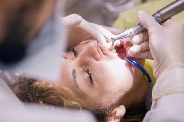 Scaling & Polishing in Fourways